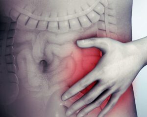 IBS is an uncomfortable condiion of the gut that hypnotherapy can help.