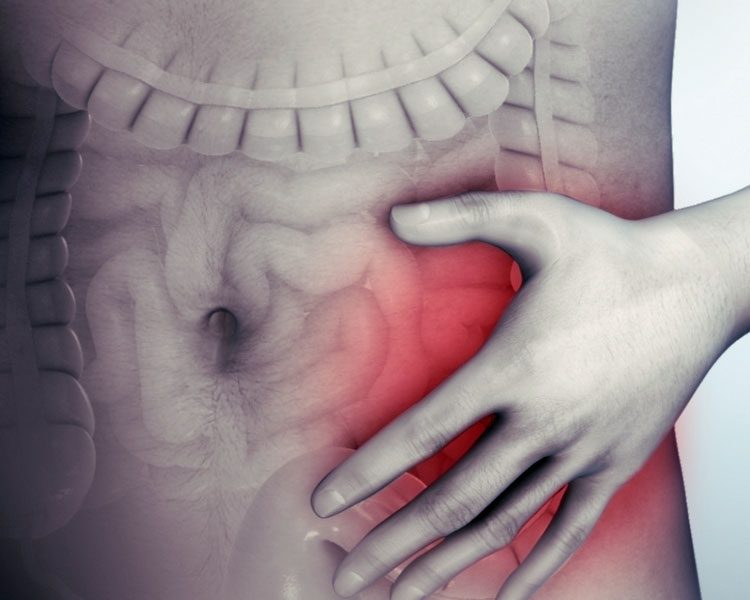 IBS is an uncomfortable condiion of the gut that hypnotherapy can help.
